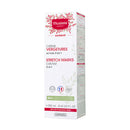 Stretch Marks Prevention Cream
